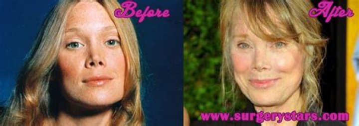 Sissy Spacek Before and After, Does Sissy Spacek Have Plastic Surgery? Did Sissy Spacek Have A Nose Job?